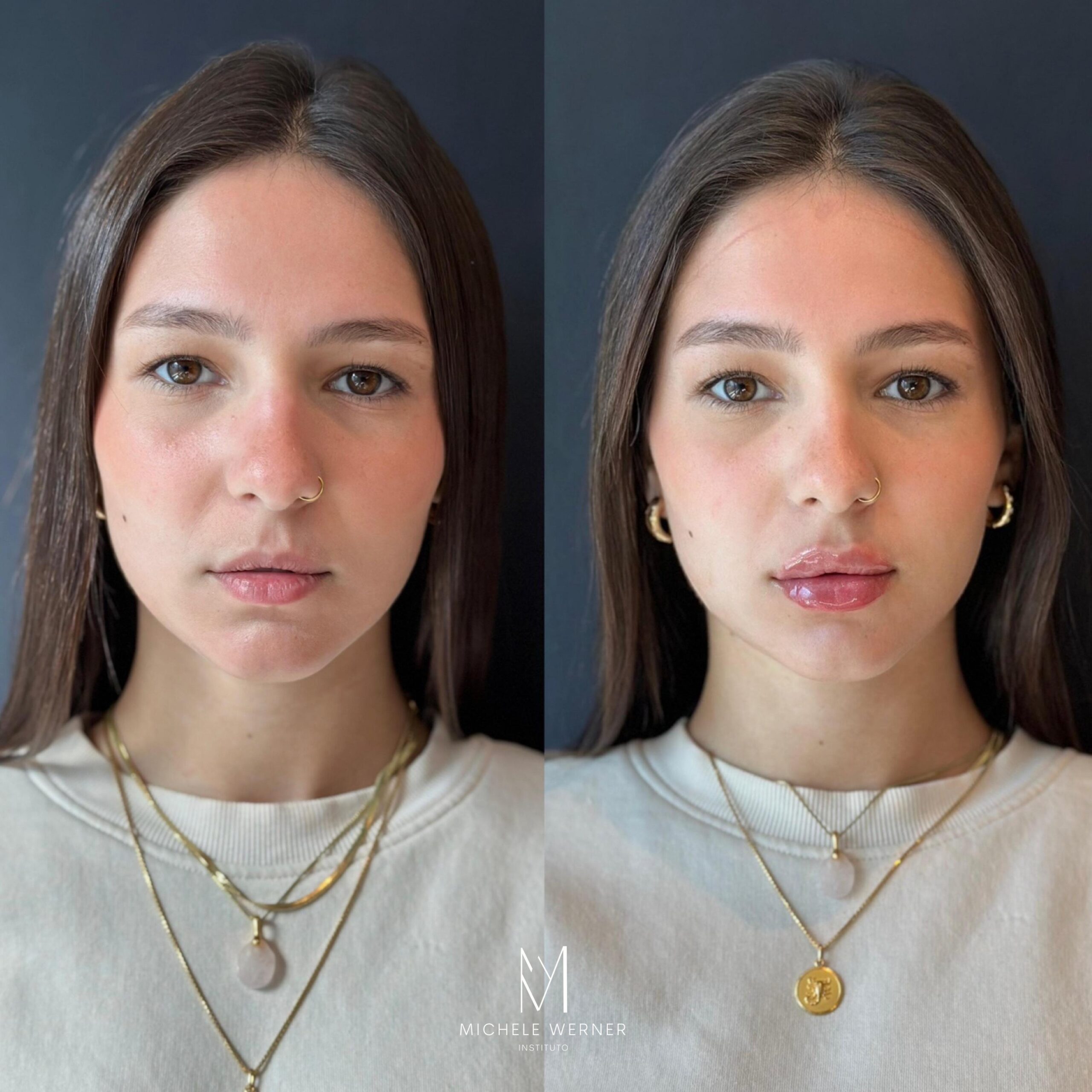 Dra Michele Werner HOF 1