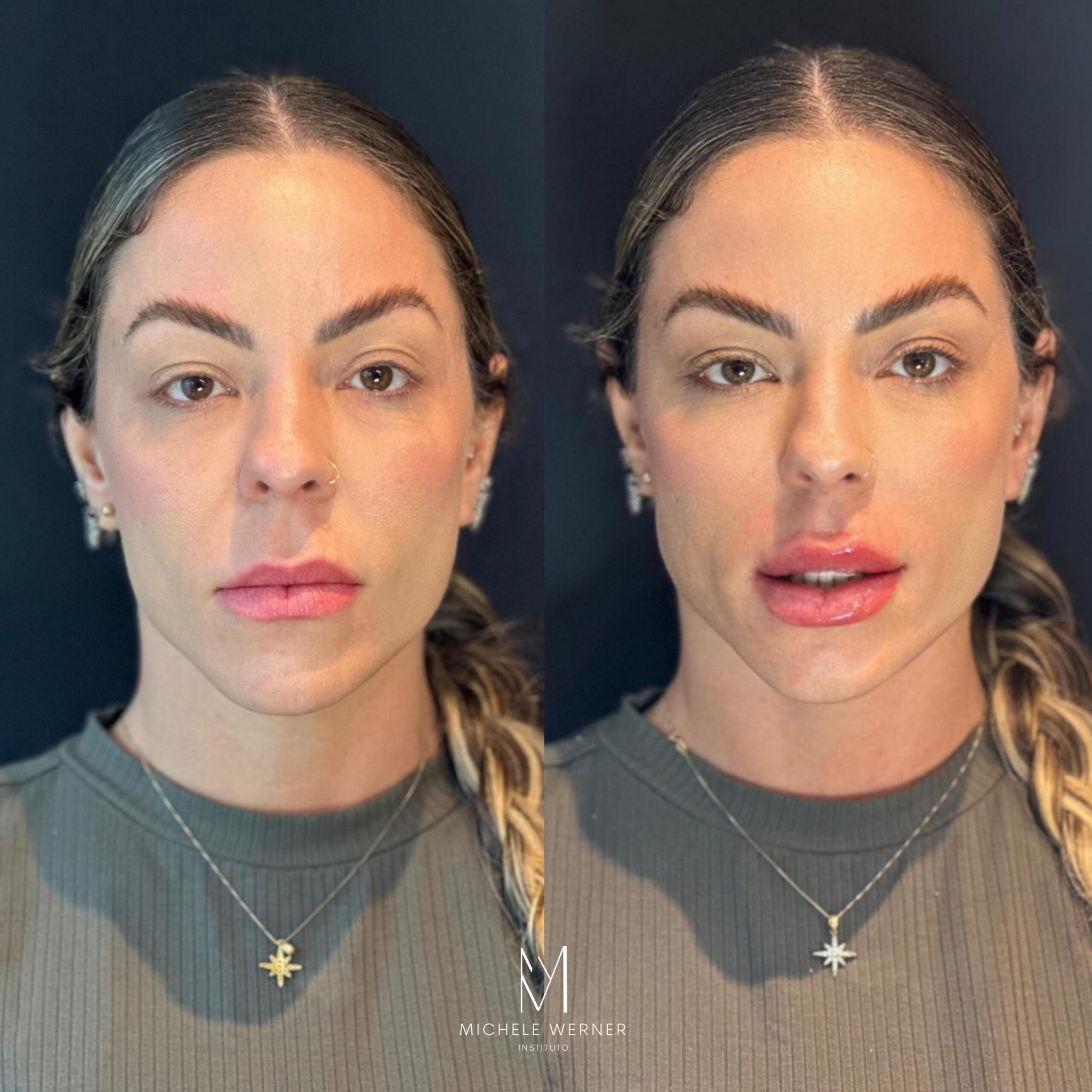 Dra Michele Werner HOF 2