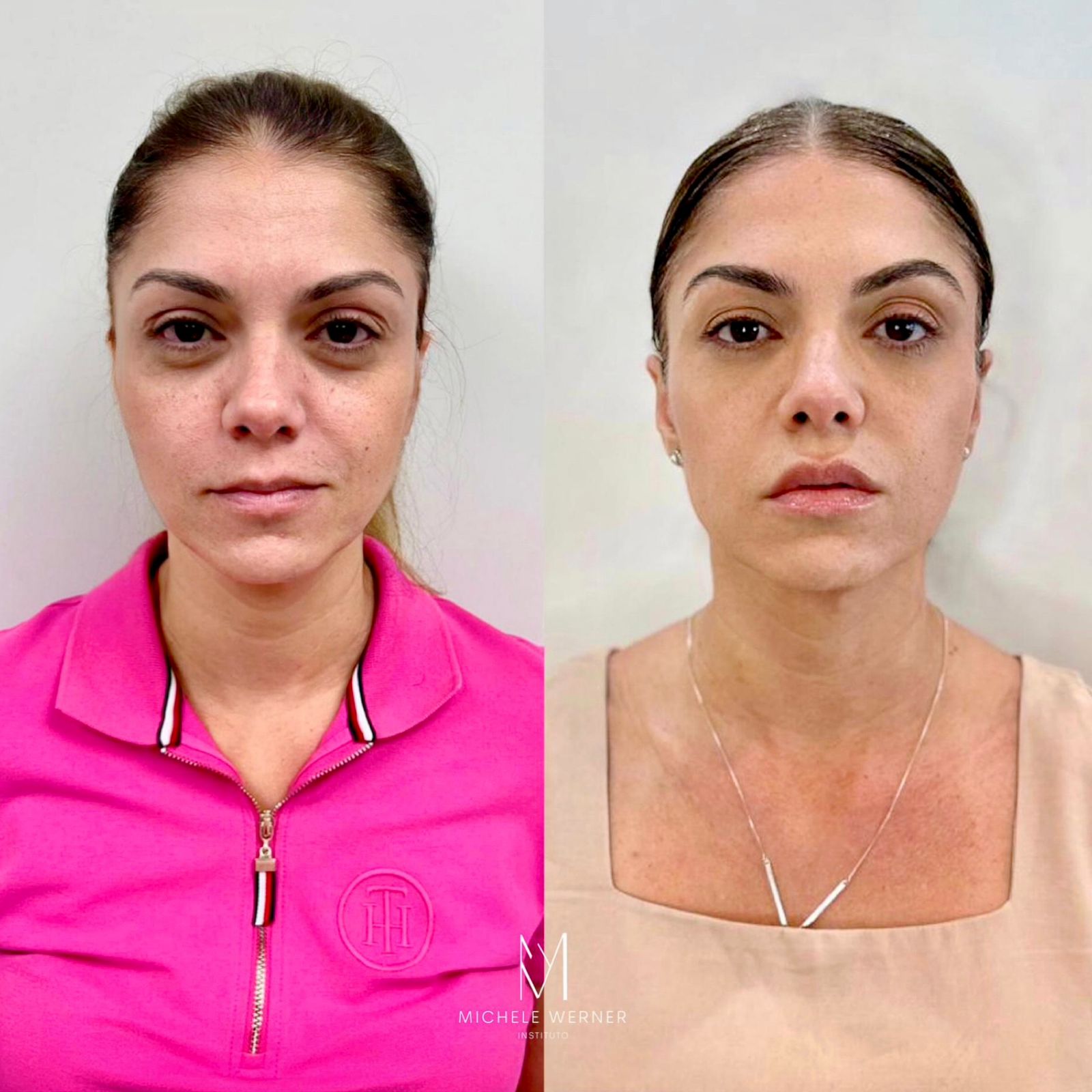 Dra Michele Werner HOF 4