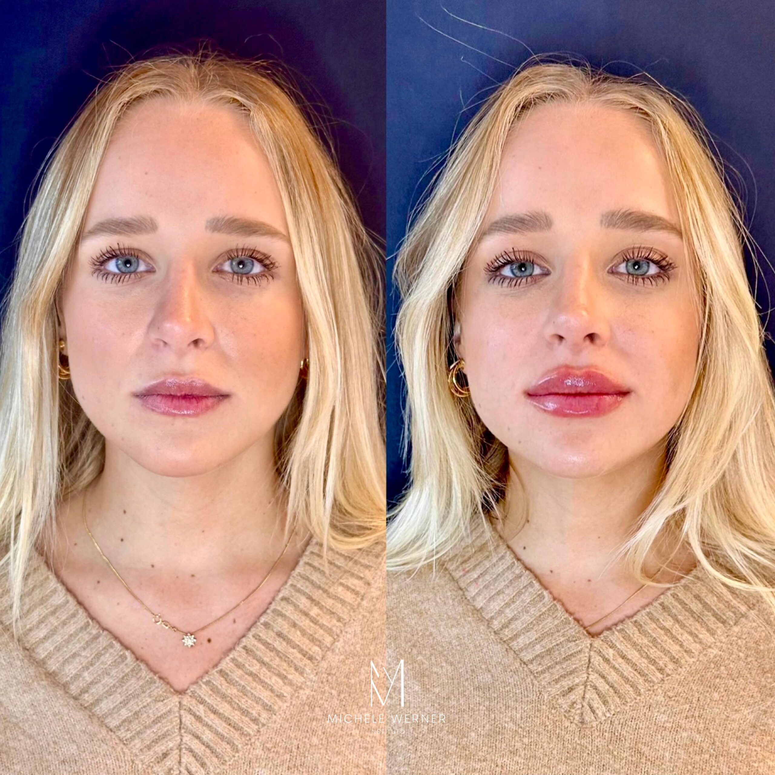 Dra Michele Werner HOF 5